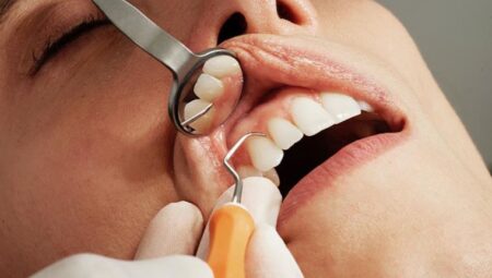 Araştırma: Diş sağlığı kötü olanların Alzheimer’a yakalanma oranı daha yüksek